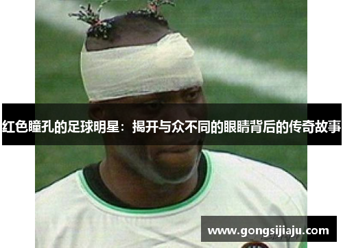 红色瞳孔的足球明星：揭开与众不同的眼睛背后的传奇故事